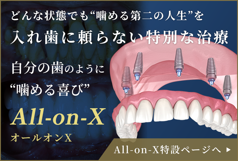 All-on-X特設ページへ